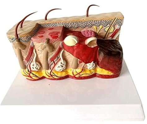 Pathologisches menschliches Hautgewebe, hierarchisches anatomisches Modell, Dermatologie, Schönheitslehrmodell für die medizinische Lehre