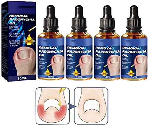 LWuuywa German Toenailplus Anti Paronychia Relief Oil, 10ML Korrektur Behandlung Öl, Nagelpflege pflegend Einwachsen Zehennagel Anti Paronychia Hilfe Öl, eingewachsene Zehennagel Tropfen