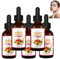 Olio essenziale di rosa canina per il viso, olio essenziale di rosa canina per la cura della pelle per le donne, olio essenziale di rosa canina naturale, olio per la cura della pelle per il viso