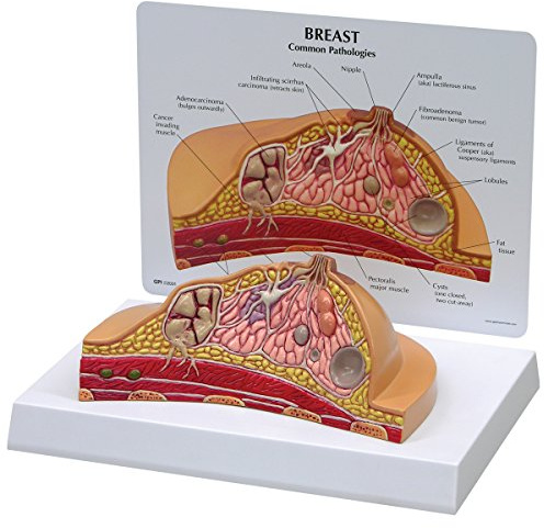 GPI Anatomicals W33351 Brust Modell Querschnitt
