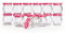 VBS XXL Bocaux à provisions Ventrus 16 pièces 5,5x6cm 80ml avec couvercle à visser Boîtes à provisions Conservation bocaux