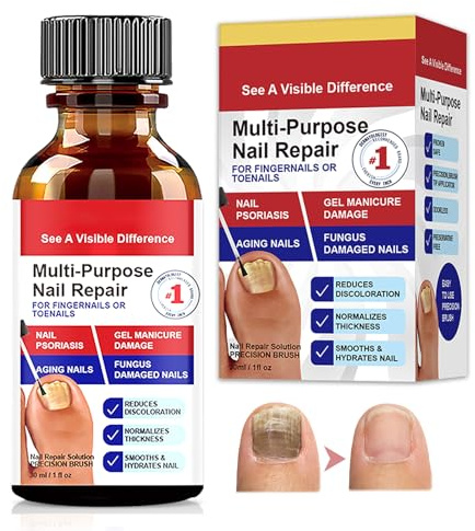 30ml Nail Care Flüssig,Fördert gesundes Nagelwachstum,Stärkung brüchiger Nägel,Für Reparatur und Schutz der Nägel,Geeignet Nagellack für Füsse und Hände