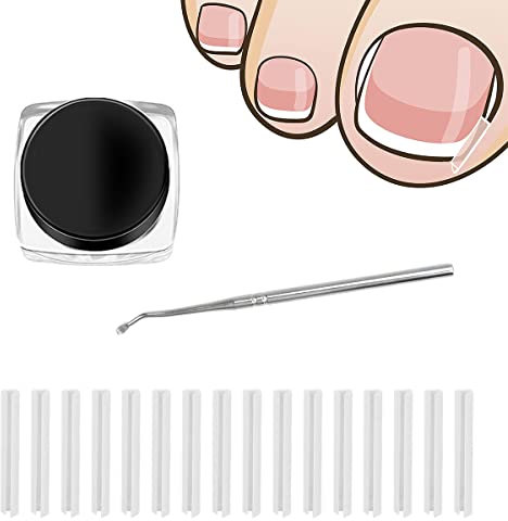 50pcs Ingrown Toenail Treatment and Corrector Kit Ingrown Toenail Correction Strips Ingrown Toenail Correction Patches Recover Clips Kit with Nail Clippers for Ingrown Toenails Foot Care Treatment