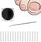 50pcs Ingrown Toenail Treatment and Corrector Kit Ingrown Toenail Correction Strips Ingrown Toenail Correction Patches Recover Clips Kit with Nail Clippers for Ingrown Toenails Foot Care Treatment