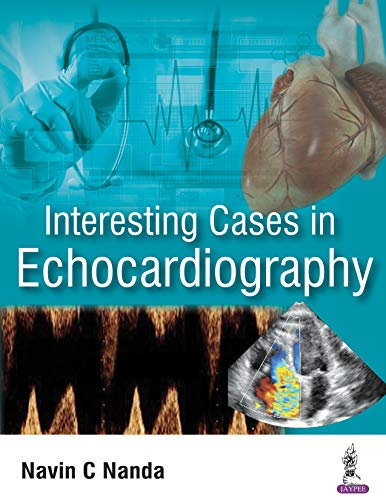 Interesting Cases in Echocardiography (English Edition)