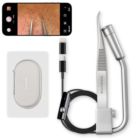 Luma 1 Pince à Points Noirs avec Caméra – Pince Extractrice avec Caméra 20x Zoom, 1080P, 8 LED, Design Dauphin, Acier Inoxydable Non Magnétique, Nettoyeur de Pores