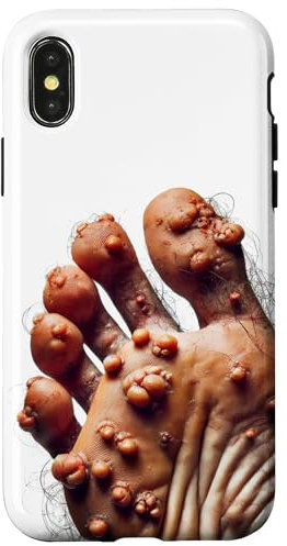 iPhone X/XS Funny Ugly Cringe Phone Case