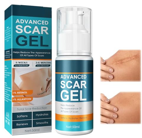 Gel De Cicatrice En Silicone,Gel Cicatrice,Gel De Cicatrice Pour Le Visage,Gel D'Élimination Des Cicatrices,Gel Cicatrice En Silicone Avancé,Gel Crème Cicatrice,Pour Cicatrices Anciennes Et Nouvelles
