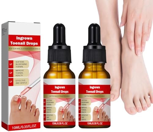 XdealCozyxc 2PCS*10ML Ingrowing Toenails Nail Softener for Thick Toenails Ingrown Toe Nail