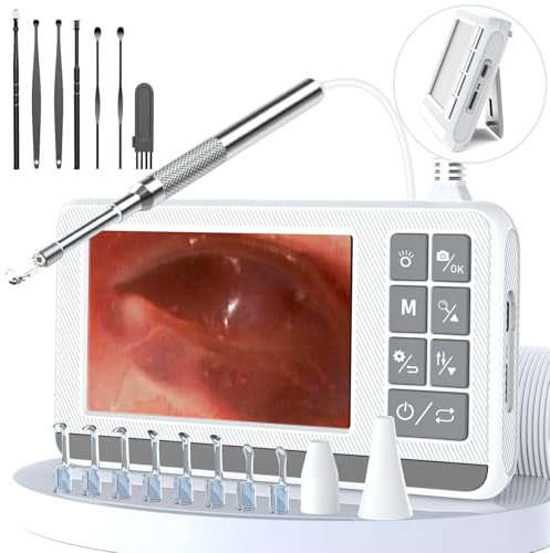VITCOCO Otoscope Ear Cleaner with 4.3-inch Screen, Ear Wax Removal Tool Kit 3.9mm Waterproof Ear Wax Remover