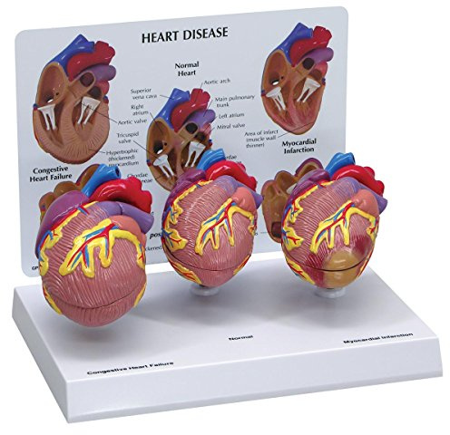 GPI Anatomicals W33365 Herz Modell mini Set