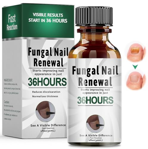 30 ml Soluzione per la Cura Delle Unghie, Dell'unghia Nutre e Lenisce Le Unghim Trattamenti per Unghie, Proteggi le Unghie Fragili, Riparazione Unghie per Rinforza la struttura dell'unghia