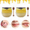 2PCS Bee Lip Balm Honey Pot, Honey & Strawberry Propolis Moisturizing, Hydrating & Prevention Dry and Cracked Lip Scrubs Exfoliator (B)
