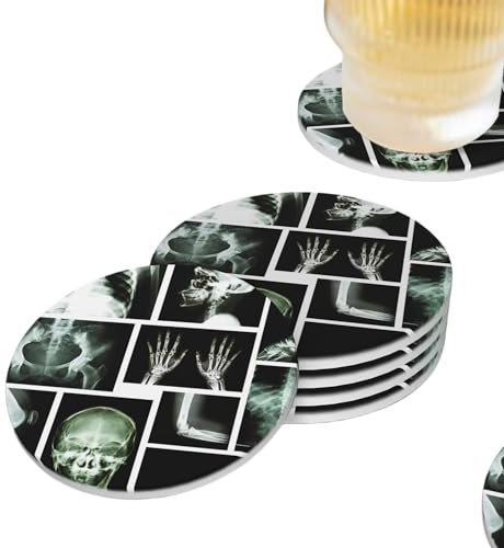 Totenkopf X Ray Untersetzer für Getränke, 4er-Set, saugfähige Keramik-Getränkeuntersetzer für Couchtisch, Holztisch, Tasse, Bar, 10,2 cm