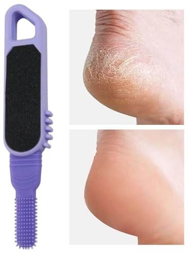 Foot Scrubber - Foot Remover | Steel Foot Scraper, with Dead Skin Catcher – the ingenious foot scraper for -free pedicures, heel scraper and cracked feet