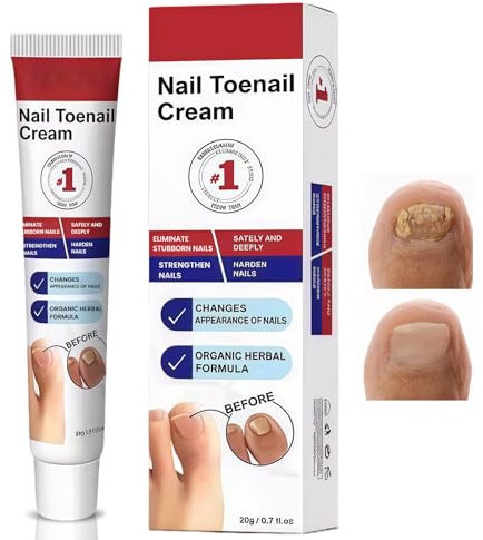 20g Crema per Riparazione Unghie, Cura Unghie Piedi, Soluzione per La Cura Delle Unghie, Rinforzante Unghie, Nail Repair per Restores Appearance of Discolored or Damaged Nails