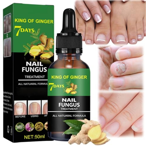 Ginger Fungal Nail Treatment,Ginger Nail Growth Serum,Ginger Cuticle Care Oil for Nails,Ginger Infused Serum Anti-Fungal Care,Ingrown Toenail Treatment,Fungal Nail Treatment for Toenails Extra Strong