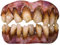 Trick or Treat Studios Bitemares Adult Costume Teeth - Zombie