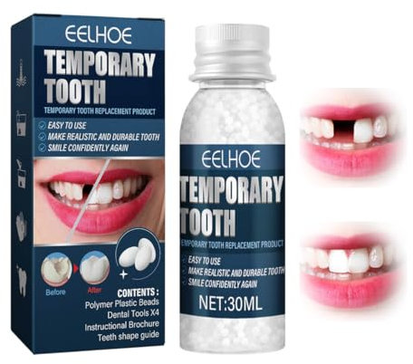 OYZOQ Denti finti da applicare da soli,cemento per denti, otturazioni fai da te, per riparare denti rotti, 30 ml