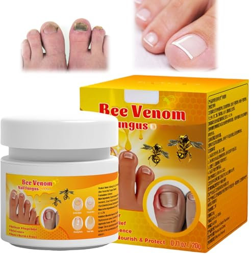 Bee Venom Fungal Nail Treatment,Bee Venom Nail Treatment Cream,Nail Fungus Treatment For Toenail,Gentle Toe Nail Fungal Treatment,Natural Bee Venom Fungal Nail Cream,Effective Nail Repair Cream