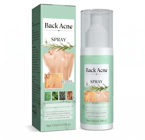 Rücken Akne Spray, Anti Pickel Creme Teebaumöl, Körper Aknes Cream, Rückenpeeling Reinigt den Körpers Tief von Überschüssigem Fett, Gegen Pickels Rückens, Sanft zur Haut,120ml