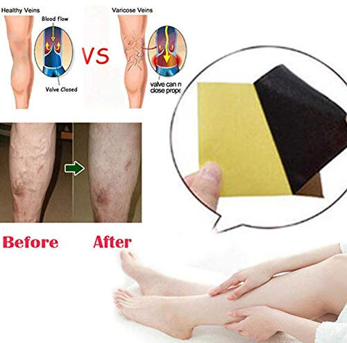 Lot de 18 pansements de traitement contre les varices et la vasculite chinoise traditionnelle à base de plantes médicinales chinoises