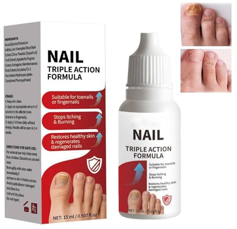 Nail Care Oil Extra Strong, Toenail Nail Growth Serum, Nail Growth Serum - Renew & Revitalize Damaged, Discolored Nails for Healthier, Clearer Toenails, Fast-Acting Formula