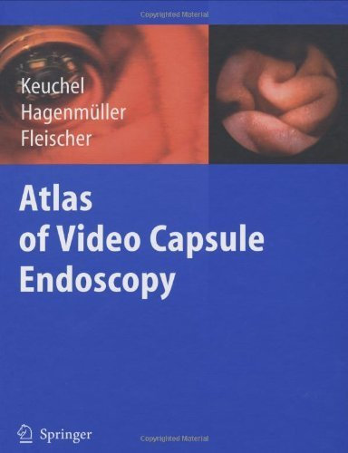 Atlas of Video Capsule Endoscopy (2006-06-30)