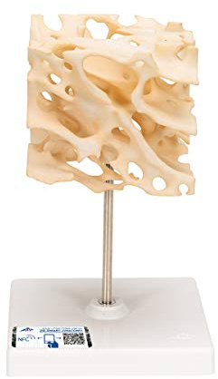 3B Scientific Menschliche Anatomie - Knochenspongiosa (Schwammknochen) Modell, 100-fach vergrößert + kostenlose Anatomie App - 3B Smart Anatomy