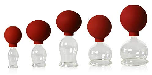 Lauschaer Glas 5er Schröpfglas-Set mit Ball 20-30-40-50-60mm zum professionellen, medizinischen,feuerlosen Schröpfen mundgeblasen, handgeformt, Schröpfglas, Schröpfgläser, Lauschaer Glas