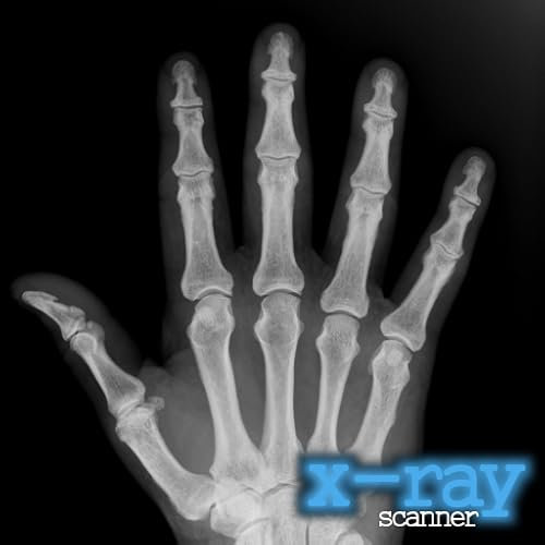 X-Ray Scanner (Ad-Free)