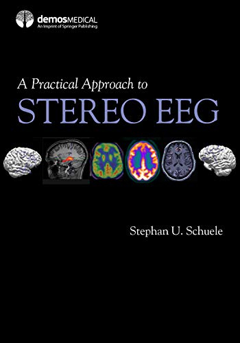 A Practical Approach to Stereo EEG (English Edition)