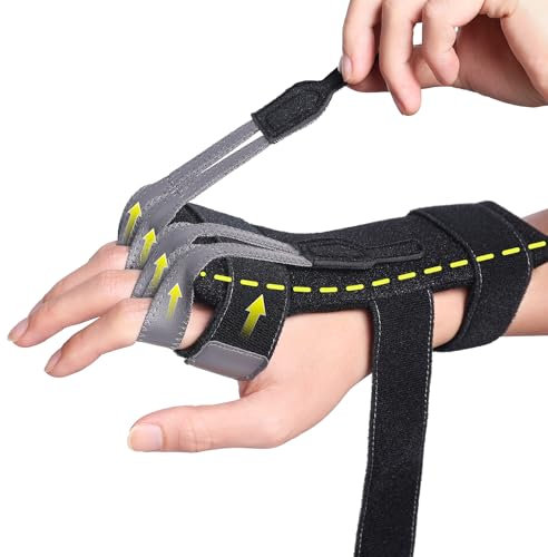 Handschiene für Radiale Nervenparese zur Fingerstreckung,Handgelenksabfall,Krückenparese,MCP-Arthroplastik,Radiale Nervenverletzung,Finger Schlaff,Verstellbare Handorthese für Rechte & Linke Hand