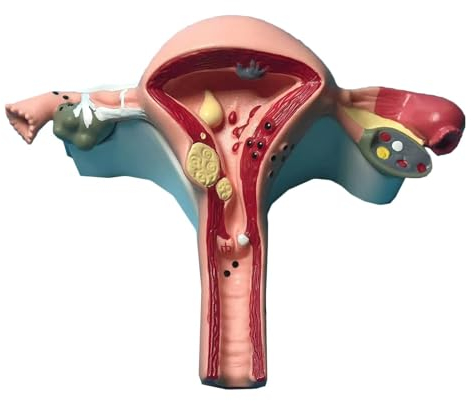 BALENFAY Weibliches Uterusmodell, Lehrmodelle Pathologisches Uterus-Anatomiemodell, menschliche Organanatomie, medizinische Anatomie menschliches Uterusmodell for Ärzte
