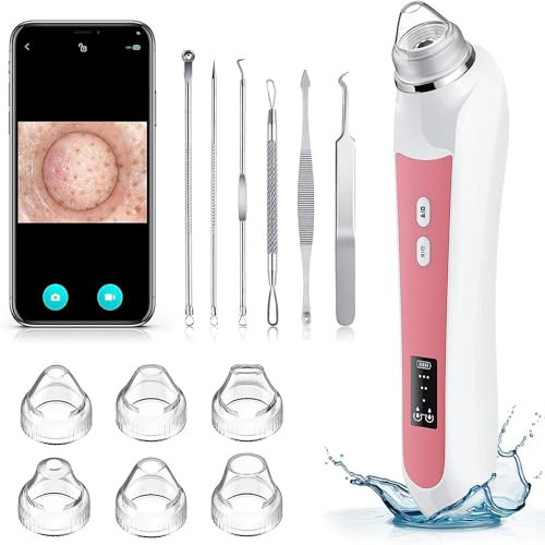 Aspirateur Ottleba Tire-comédons avec Caméra HD, Nettoyeur de Pores en Acier Inoxydable, 3 Modes de Réglage et 6 Têtes d'Aspiration Rose Clair