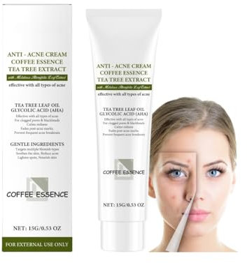 Akne-Behandlungscreme für das Gesicht – Reduziert Ausschläge, lindert Rötungen, sanfte Formel für fettige, zu Akne neigende und empfindliche Haut, tägliche Feuchtigkeitspflege zur Porenreinigung