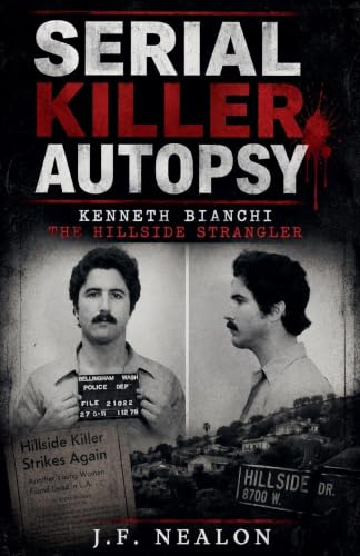 Serial Killer Autopsy: Kenneth Bianchi