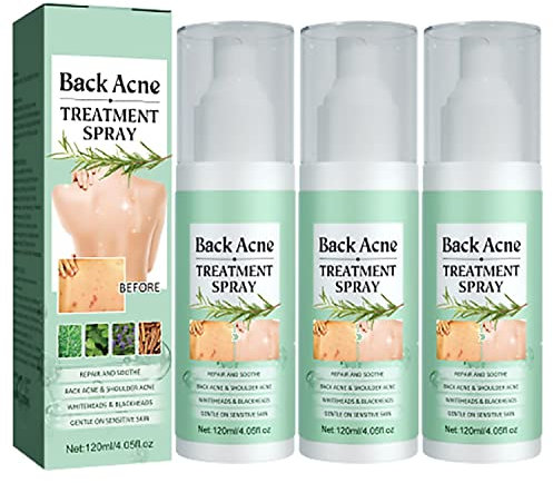 Toxiklenz Back Acne Treatment Spray,Back Acne Spray, Tea Tree Oil Back Acne Solution,Acne Free Salicylic Acid Back Body Spray (3 Pcs)