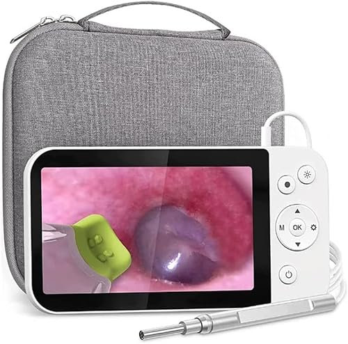 Limpiador De Oídos, Endoscopio para Oídos, Herramienta De Extracción De Cera para Oídos con 6 Luces LED Ajustables Y Kit De Limpieza De Puntas para Oídos, Fácil De Usar para Niños/Adultos/Mascotas