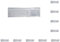 10 Set Tastatur-Abdeckungen aus Silikon für Computertastaturen, Universal-Tastatur-Schutz, Laptop-Zubehör