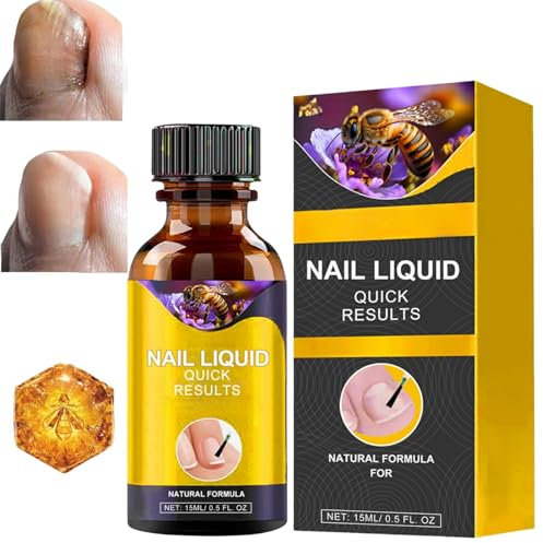 15ml Bee Venom Fast-Acting Anti-Fungal Nail for Toes and Fingers,Bee Venom Nail Treatment Serum,Fungal Nail Treatment for Toenails,Fungal Toenail Treatment,Fungal Nail Polish,Ingrown Toenail Treatment