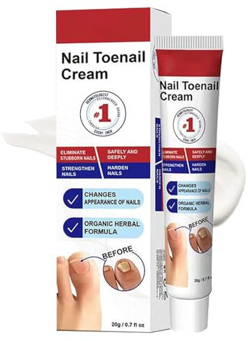 Antifungal Ointment for Onychomycosis, Powerful Antifungal Toenail Cream for Toenail Fungus, Foot Care Cream with Nourishing Oils for Nail Growth and Nail Repair, 20 GM