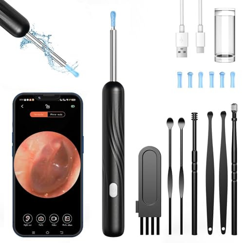 Ohrenschmalz Entferner Otoskop, Euakee 1080P WIFI Ohrreiniger für Erwachsene, IP67 Wasserdicht Ohrenreiniger für Erwachsene & Kinder, Ohr Reinigung für iPhone, iPad, iOS, Android (Schwarz)