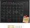 TORASO Kalender-Kreidetafel, kleine magnetische Oberfläche, schwarzer Holzrahmen, Kreidetafel für Planung/Schulstundenplan/Memo, 30 x 39,9 cm, Hängetafel für Büro, Schule und Zuhause (YLHB-BK-3040)