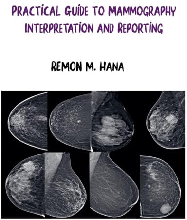 Practical Guide to Mammography Interpretation and Reporting