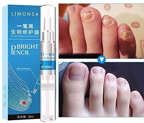 Ofanyia Nail Fungus Treatment Pencil Toenail Antifungal Care Fungal Nail Liquid Anti Fungus Nail Treatment Pen