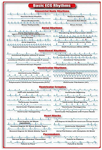 FJQWKLF Grundlegende EKG-Rhythmen, Infografik, Metallschild, Kardiologie-Studienführer, Poster, Kardiologe, Bürodekoration, Wanddekoration für Zuhause, 20,3 x 30,5 cm