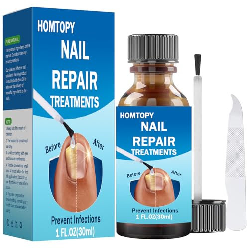 Fungal Nail Treatment for Toenail Extra Strong, Toe Nail Fungus Treatment for Toenail with Nail File, Nail Repair and Strengthen, Fixes Discolored Nails - 30ml