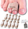 AleFlowSolutions Corrector Dedos Pies, Corrector Dedo Martillo, Férula Dedo Martillo, Te Permite Corregir Dedos en Garra, Enderezador Dedos Pie - Pack de 10 Férulas + 1 Par de Separadores