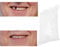 Gegong Clip nei denti delle faccette, perline di riparazione temporanea dei denti per denti rotti mancanti Materiale di riempimento dei denti dentali, cemento per denti (100g)
